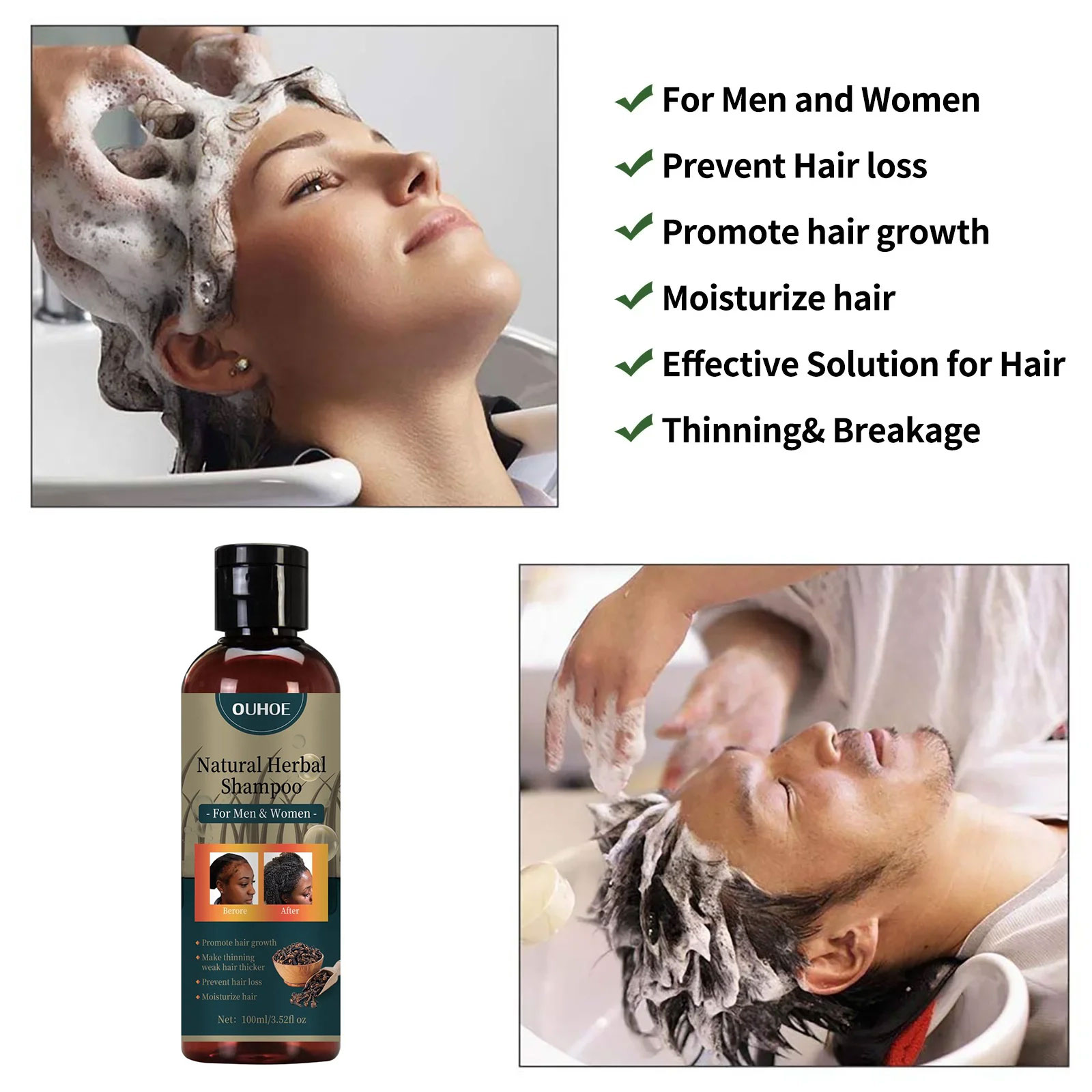 OUHOE Saç Büyüme Şampuanı Kepe - Hair Care Dandruff incelemesi ve fiyatı