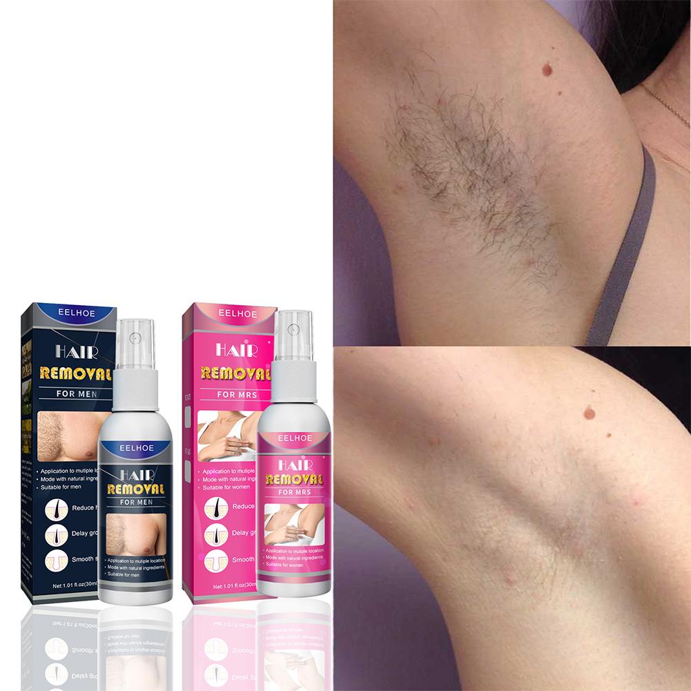 1/2 adet süper doğal ağrısız k - Hair Care Lotion incelemesi ve fiyatı